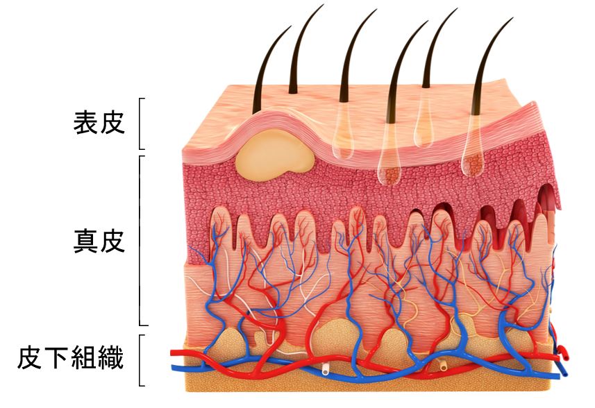 針を入れる層は真皮～皮下組織